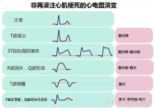 心电图口诀8