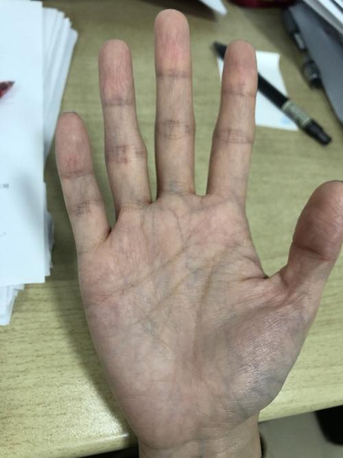 大家的手掌血管会很明显吗