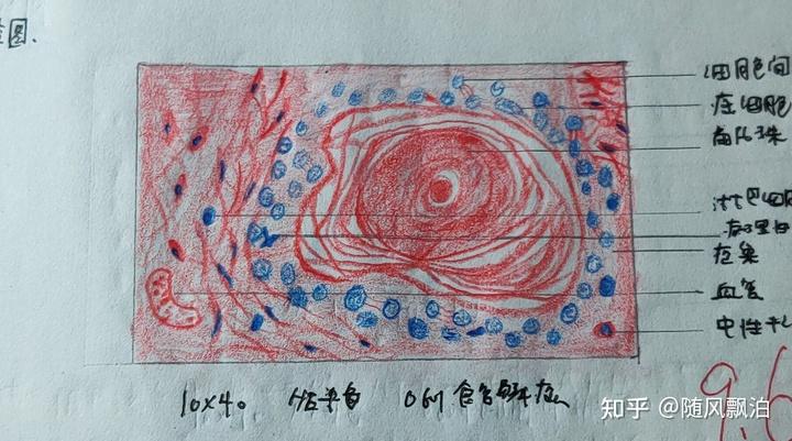 病理切片绘图 红蓝铅笔