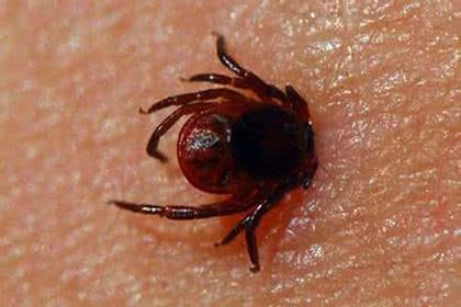 被草爬子咬了该怎么办?千万不要往下拽!你们叫这个是啥名?