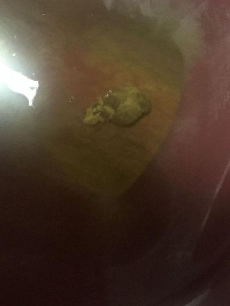 大便感觉肛门被堵住了似的 总有便意 却一次只能排一点 晚上喝了泻叶