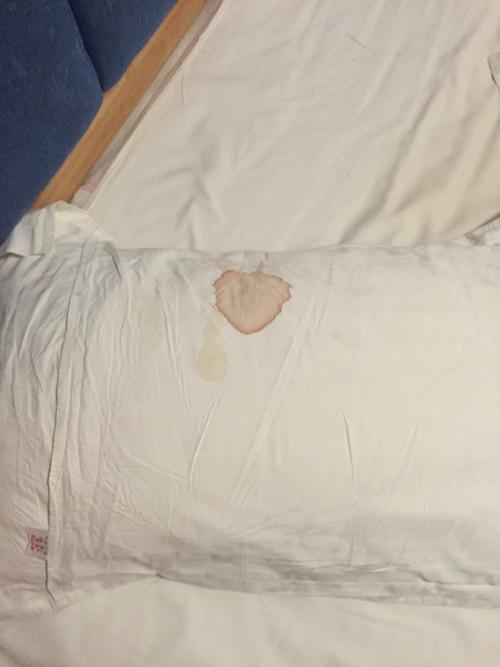 但是没出血.后来又做