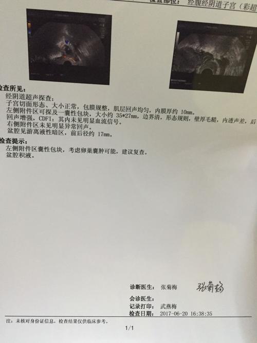 左侧附件区囊性包块大小约35*27mm严重吗