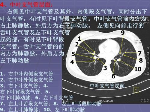 正常胸肺部ct影像学表现ppt