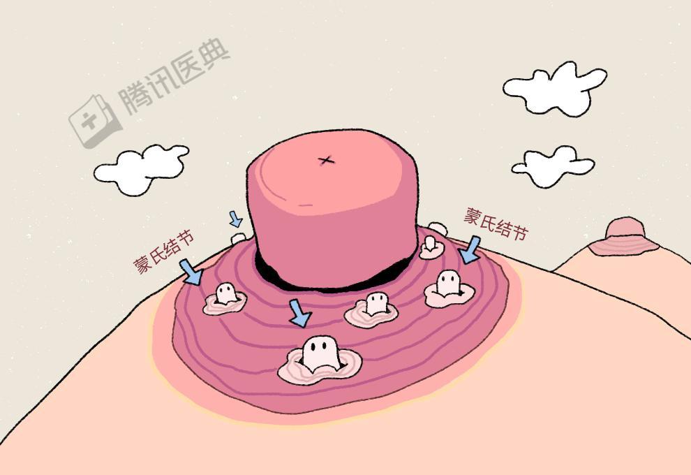 它们由分泌脂质和乳汁的蒙氏腺组成,算是汗腺到乳腺的过渡形态.