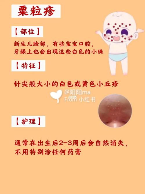 宝宝湿疹热疹痱子如何分辨71宝妈们知道吗_热疹_宝宝湿疹_痱子