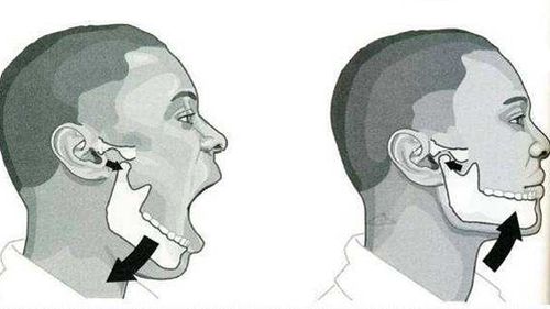 健康成年人颞下颌关节上腔造影螺旋ct扫描图像分析