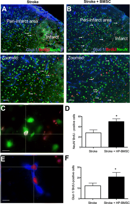 point to the presence of co-labeled cells in the peri-infarct