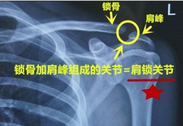 亚洲杯:国足核心球员武磊受伤他的肩锁关节脱位有多严重