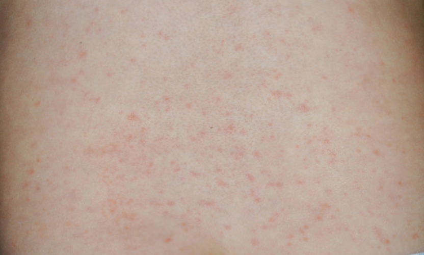 「伤寒」,可不是你以为的伤风感冒