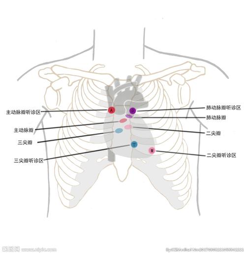 医学插画心脏瓣膜听诊区设计图__医疗护理_现