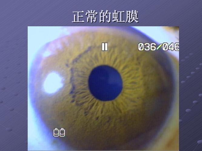 健康检测知识 正常的虹膜
