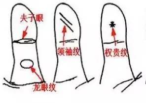 文化   大拇指第一节的节纹形成如「眼形」的,称作「夫子眼」(三条纹)