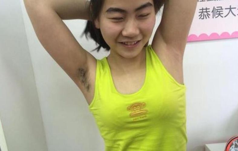 腋毛怎么去除