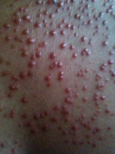 这是什么病看医生都看半个月没有好,反而更加严重!