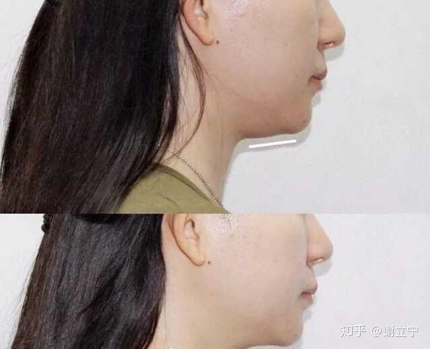 怎样才能练成完美的下颚线?