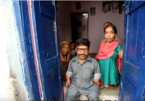 种最常见的不成比例的侏儒症,其特征是有着正常大小的躯干,但四肢短小