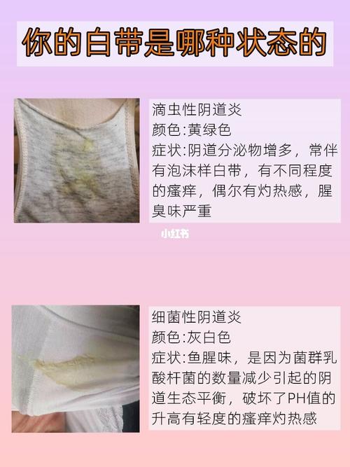 有人知道什么是细菌白带吗?_妇科炎症_阴道炎_日常
