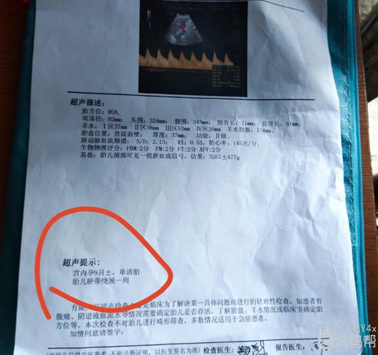 今天38周了,胎儿脐带绕颈一周,有没有事