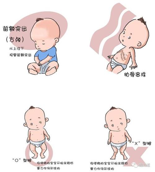 要遭殃,如果维生素d水平持续不足的话,还会导致许多其他系统的疾病