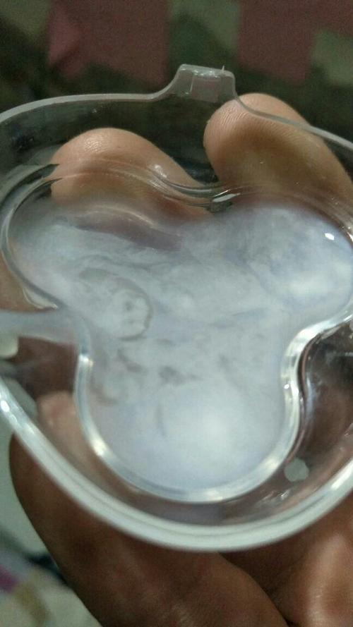 请问我这精子正常吗