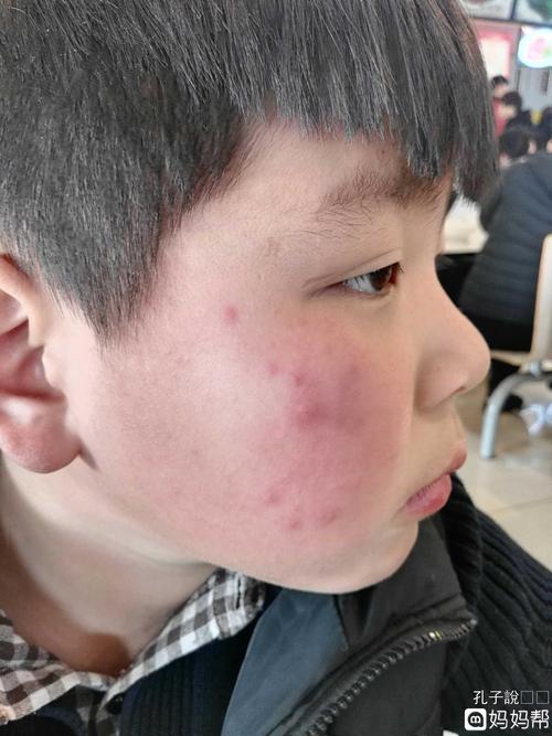 哪个宝妈知道这是怎么回事啊,大宝9岁了,脸一冻或者热
