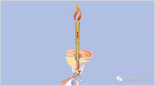"耳烛疗法"不但吸不出耳朵里的耳屎和"毒素",熔化了的蜡滴反而会进入