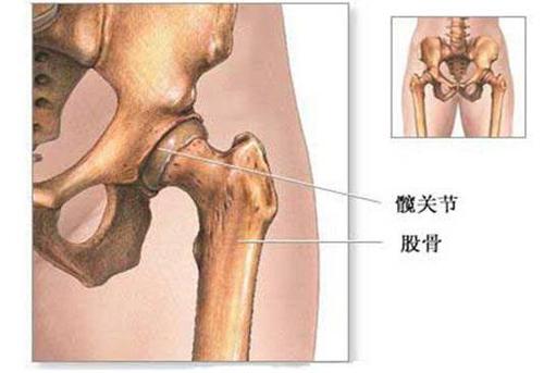 穿袜子费劲,听听髋关节有声