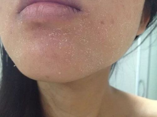 冬天大干皮救星这款香奈儿平替拯救起皮泛红卡粉一夜之间干纹消失了糙