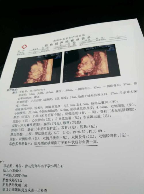 自己从图片看上去唇部好像有问题,但四维彩超