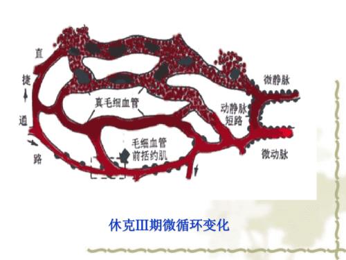 低血容量性 休克 ppt课件