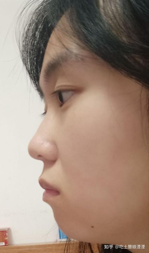 正脸好看但侧脸丑到爆是种怎样的体验?