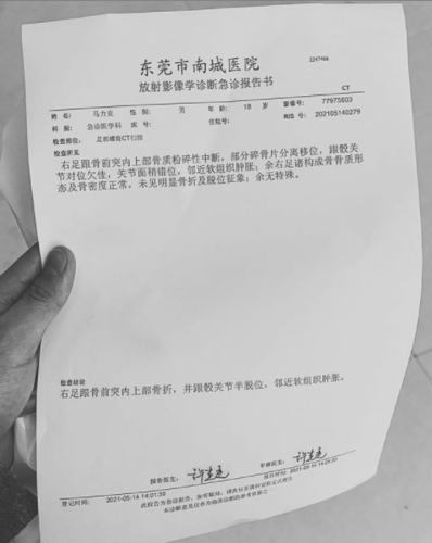 早日康复!马力克足部ct结果:足跟骨前突内上部骨折