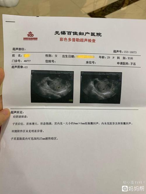孕36天 第一次做b超确认是宫内的
