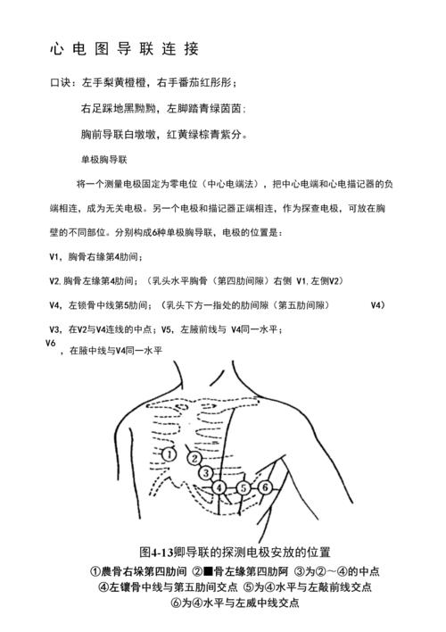 心电图导联连接快速确定位置及图示.docx