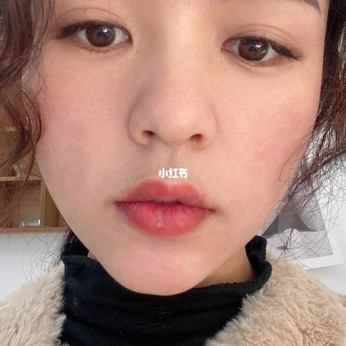 漂唇的结果_漂唇_发炎_美妆_医美整形