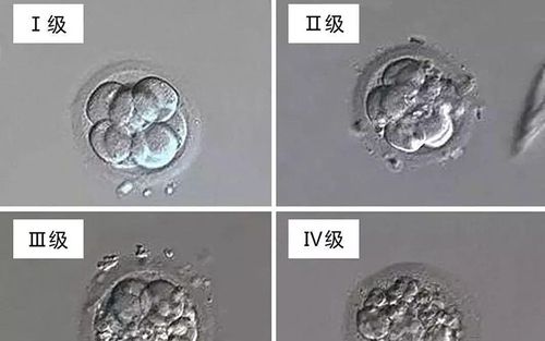 囊胚4bb,5bb哪个级别和成功率要高一些?