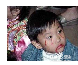 重金属中毒,严重的会产生古代人所说的"七窍流血",严重的可导致死亡