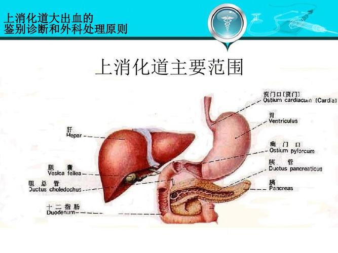 第八版外科学-41-上消化道大出血的鉴别诊断和外科处理原则ppt