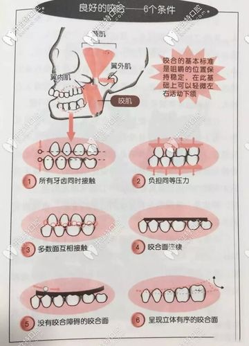 标准的牙齿咬合图片