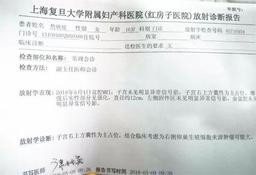 花季少女胃痛半年竟是卵巢肿瘤惹的祸