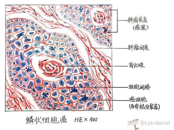 大学病理学红蓝铅笔绘图