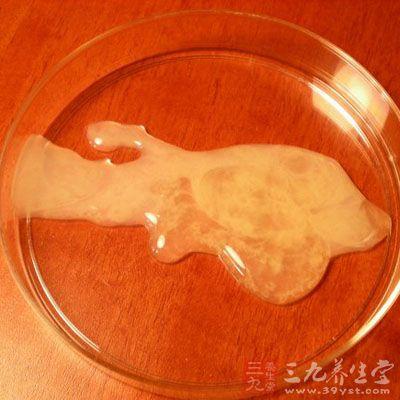 无菌性前列腺炎 怎样预防和治疗无菌性前列腺炎 (9)