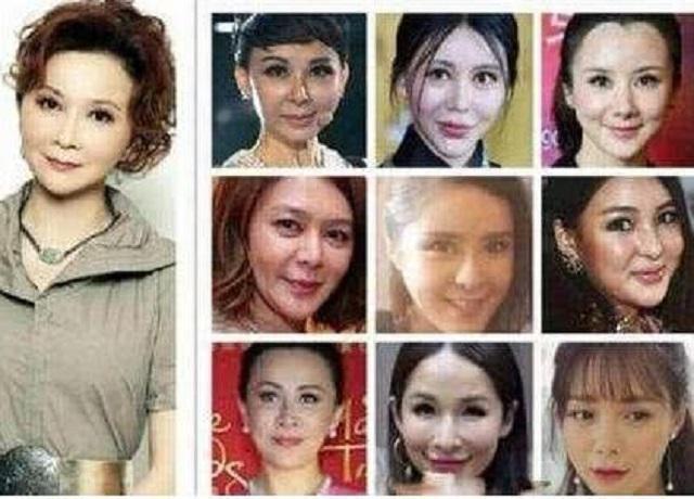 蔡明的神奇"魔咒":成为整容女星撞脸模板,其中竟有