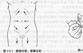 【腹壁反射】_概述_怎么看_费用多少钱_检查_百姓健康网