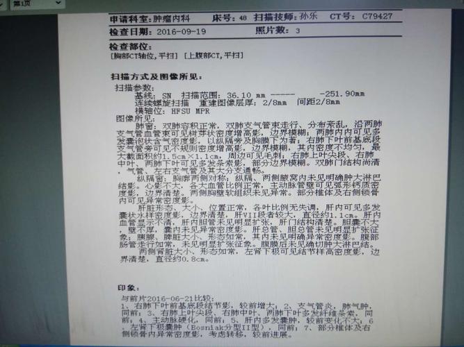 右肺腺癌多发骨转移伴多发肝囊肿及左肺囊肿一例