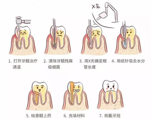 福州我得了牙髓炎吃药能治好吗
