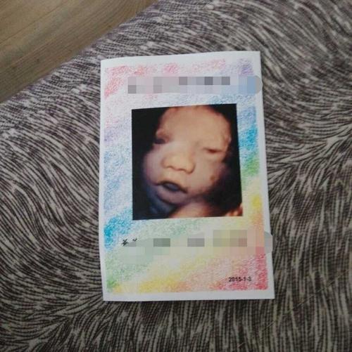 32周的宝宝彩超宝宝睁眼了猜男女了