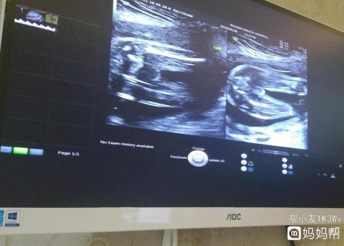 23周四维,懂的宝妈来看看是男孩女孩呀?