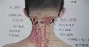 后脑勺的机关——头痛头晕治疗点